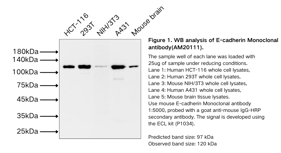 E-cadherin Mouse Monoclonal antibody