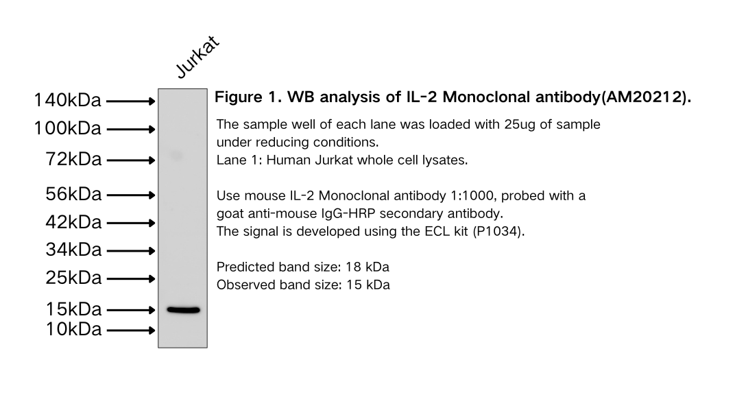 IL-2 Monoclonal antibody