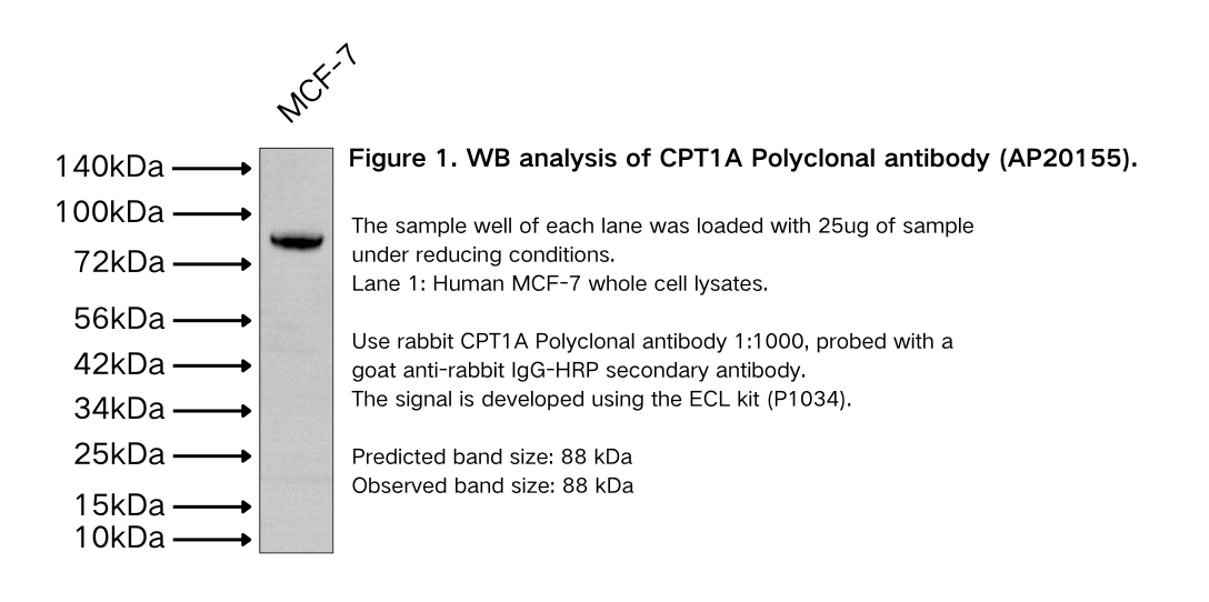 CPT1A Polyclonal antibody