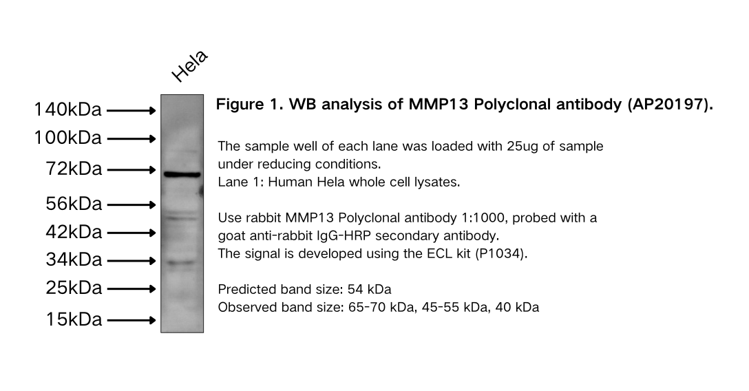 MMP13 Polyclonal antibody