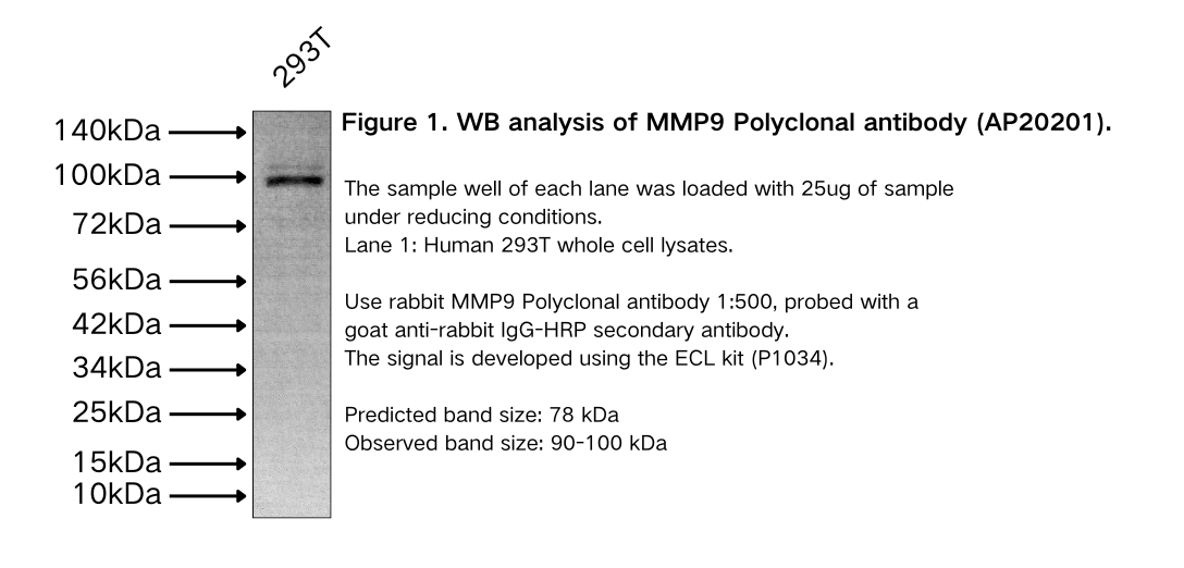 MMP9 Polyclonal antibody