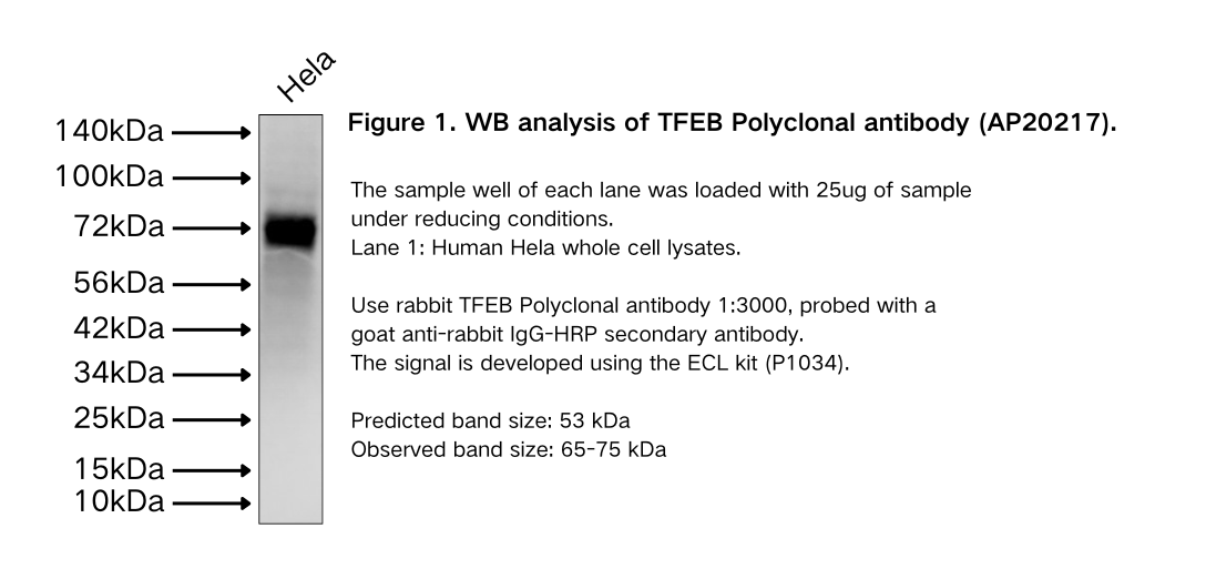 TFEB Polyclonal antibody