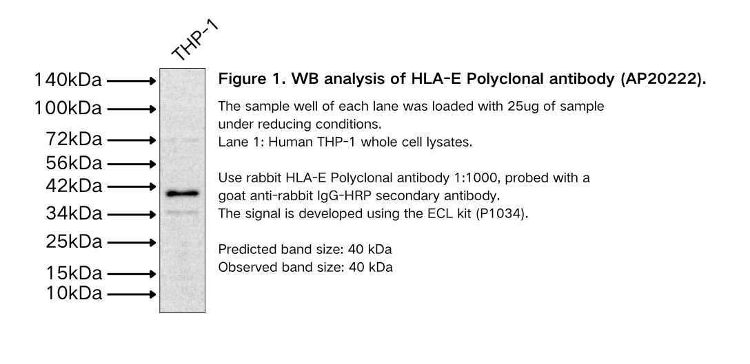HLA-E Polyclonal antibody