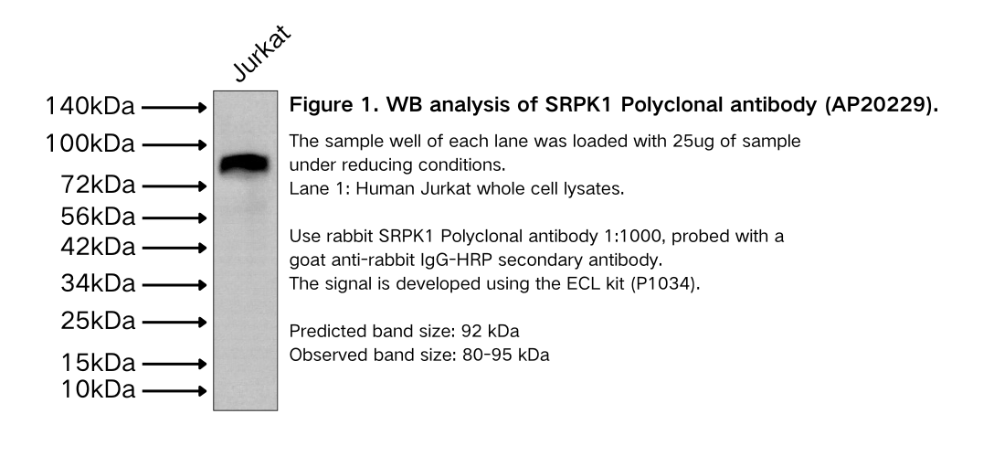 SRPK1 Polyclonal antibody