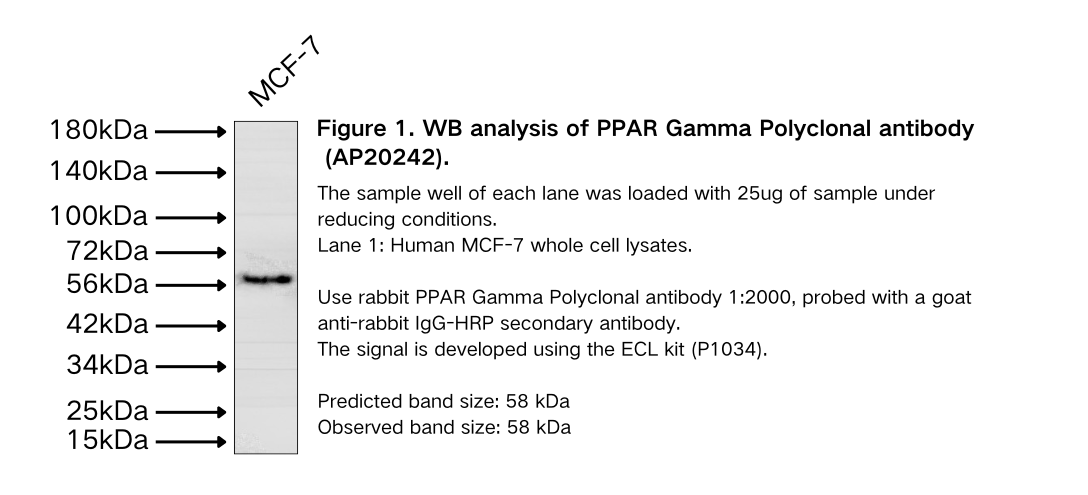 PPAR Gamma Polyclonal antibody