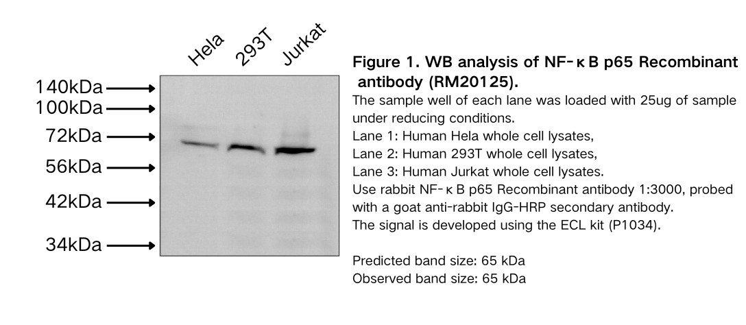 NF-κB p65 Recombinant antibody