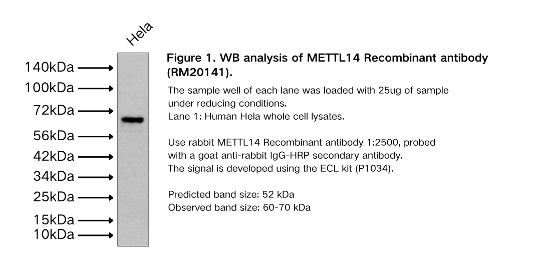 METTL14 Recombinant antibody
