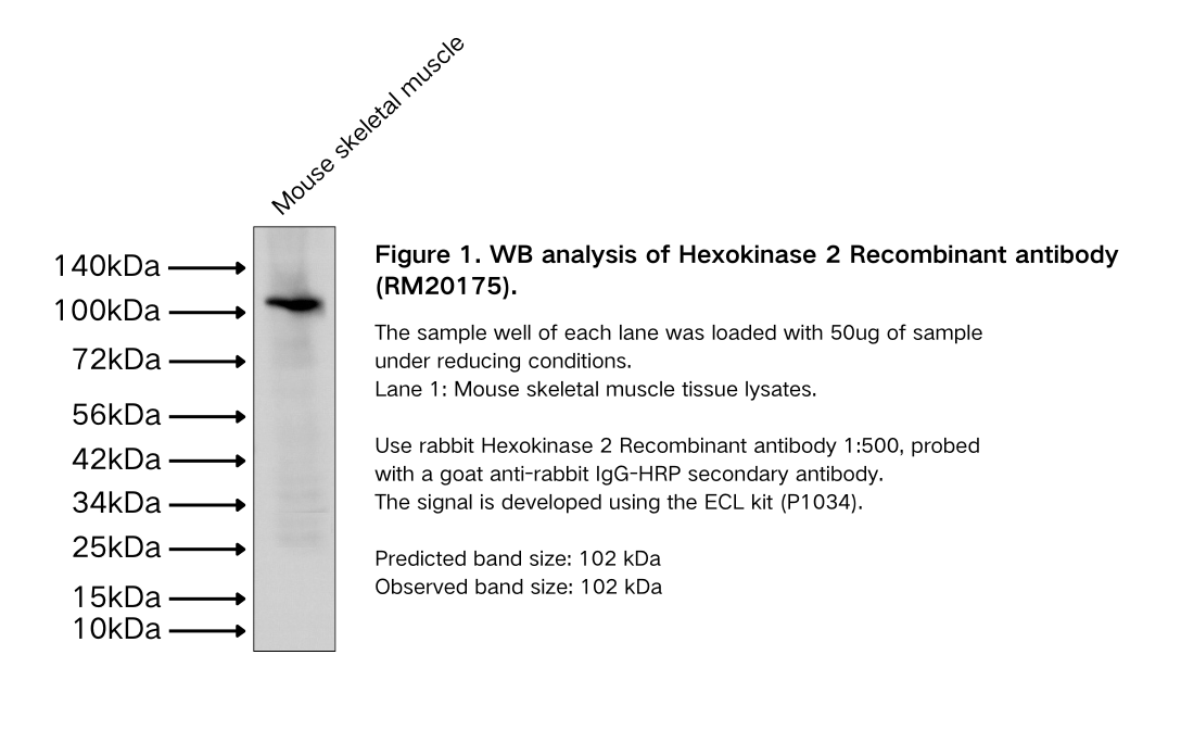 Hexokinase 2 Recombinant antibody