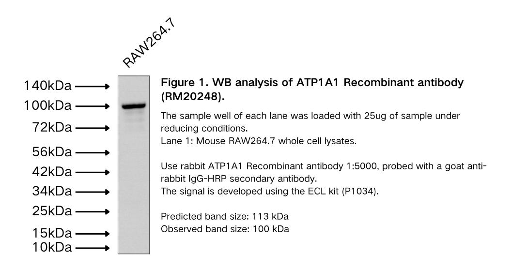 ATP1A1 Recombinant antibody